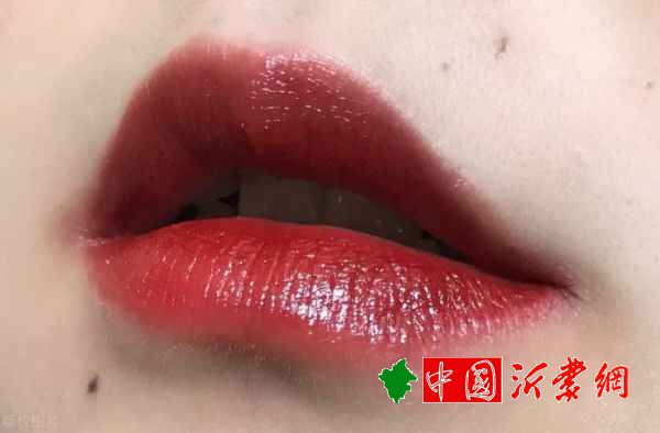 嘴唇周围发黑唇周发黑的原因和解决办法